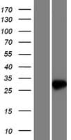 Human NUDT7 Protein (Over-Expression Lysate Myc-DDK (Flag))