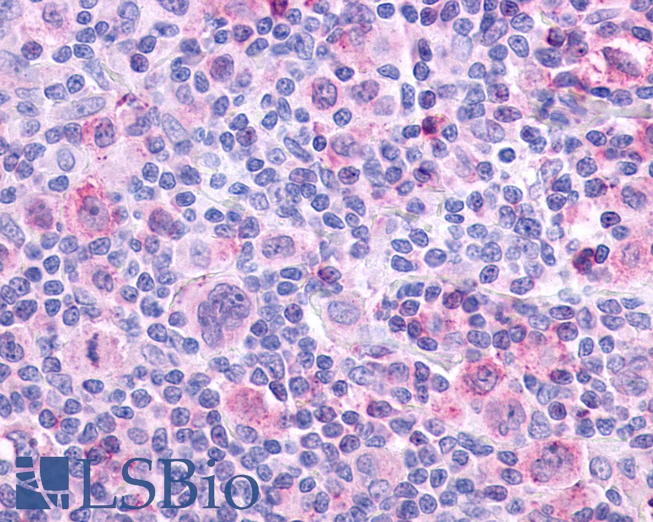 IHC-plus™ Polyclonal Rabbit anti-Human CHRM4 / M4 Antibody (Cytoplasmic Domain, IHC)