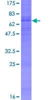 Human ADRB3 Protein (Recombinant GST)