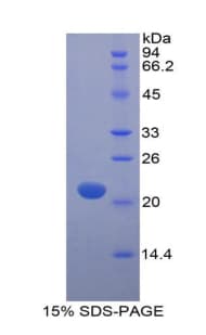 Human MYL12A / MRCL3 Protein (Recombinant His)