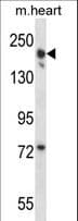 LRRC16B Antibody (aa1344-1372)