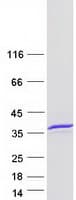 Human METTL1 Protein (Recombinant Myc-DDK (Flag))