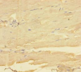 Polyclonal Rabbit anti-Human MBNL1 / MBNL Antibody (WB)
