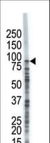 USP8 / UBPY Antibody (aa1058-1087)