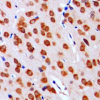 Polyclonal Rabbit anti-Human DGKA Antibody (Internal, IHC, IF, WB)