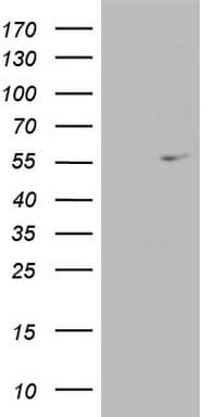 ESRRA / ERR Alpha Antibody (aa206-417, clone OTI2H9, Carrier-free)