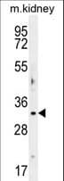 Polyclonal Rabbit anti-Human NABP2 Antibody (aa183-211, WB)