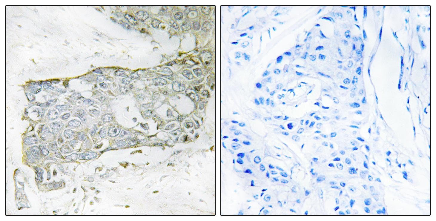 F7 / Factor VII Antibody (light chain, Cleaved-Arg212)