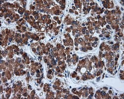 TUBA8 / Tubulin Alpha 8 Antibody (clone OTI3E10)