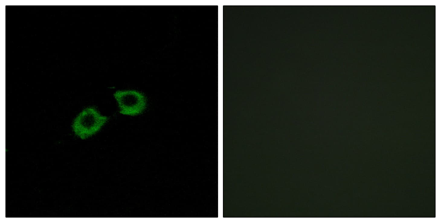 ARFGEF2 / BIG2 Antibody (aa1491-1540)