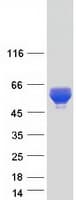Human CARD9 Protein (Recombinant Myc-DDK (Flag))