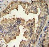 PRMT4 / CARM1 Antibody (aa346-377)