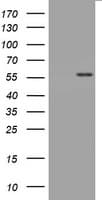 CD30 Antibody (clone OTI16H5)