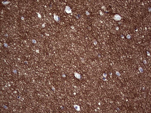 Monoclonal Mouse anti-Human NCAM / CD56 Antibody (clone OTI1A3, aa20-718, IHC, WB)