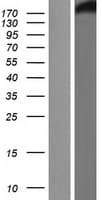 Human CHD3 Protein (Over-Expression Lysate Myc-DDK (Flag))