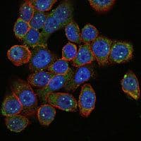 SMN1 Antibody (clone 5H1)