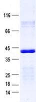 Human C2orf73 Protein (Recombinant His, N-Terminal)