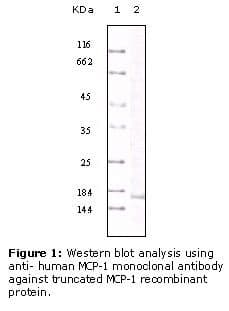 CCL2 / MCP1 Antibody (clone 1A7B8)