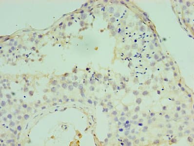 Polyclonal Rabbit anti-Human ATF7 Antibody (aa1-117, IHC, WB)
