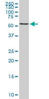 B4GALNT1 / GM2/GD2 Synthase Antibody (clone 5F9)