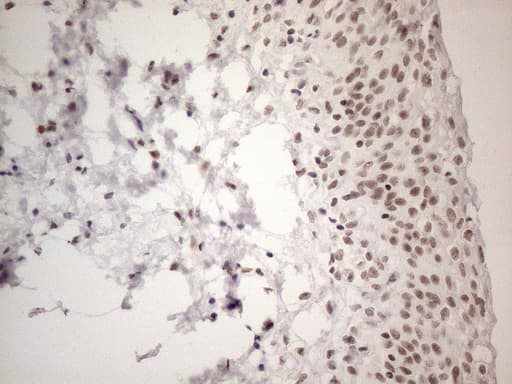 NR2C2 / TAK1 Antibody (aa1-241, clone OTI2H2)