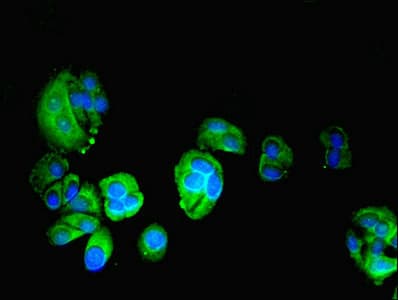 IHC-plus™ FARSA Antibody (aa2-508)