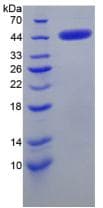 Mouse CRH / CRF Protein (Recombinant His-GST)