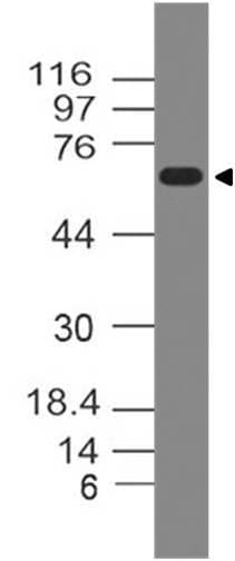 GAD65 Antibody