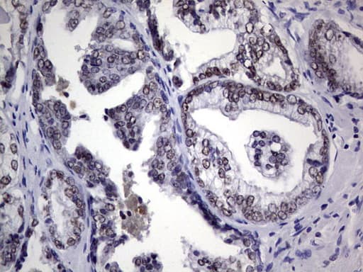 Monoclonal Mouse anti-Human NKX3-1 Antibody (clone OTI1B4, IHC, WB)