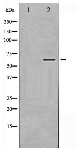 CaMKII Alpha+Beta+Delta Antibody (phospho-Thr305)