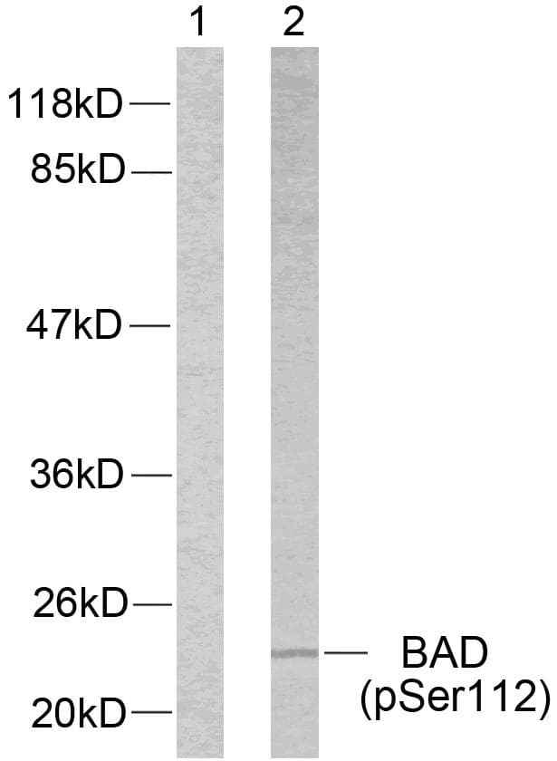 BAD Antibody (phospho-Ser112)