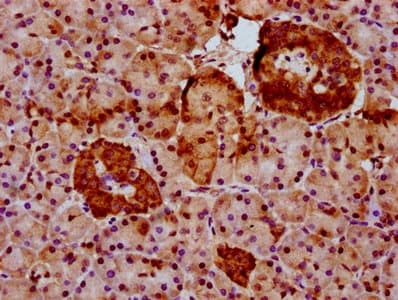 GLTSCR2 Antibody