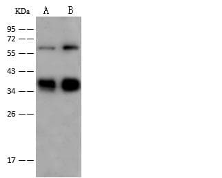 Polyclonal Rabbit anti-Human GYPC / Glycophorin C Antibody (Preservative Free, IHC, WB)