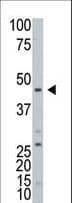 Polyclonal Rabbit anti-Human ART3 Antibody (aa280-310, WB)