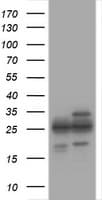 PSMA2 Antibody (clone OTI3E9)
