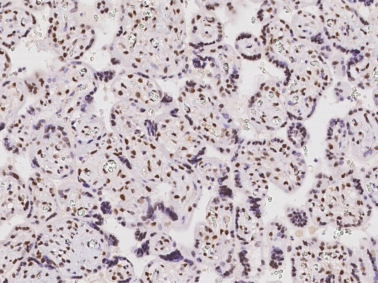 Polyclonal Rabbit anti-Human ZNF512B Antibody (IHC)