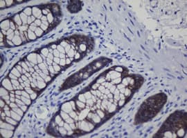 CDH1 / E Cadherin Antibody (clone OTI1G1, Carrier-free)