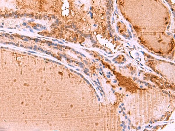 Polyclonal Rabbit anti-Human HTRA4 Antibody (IHC, WB)