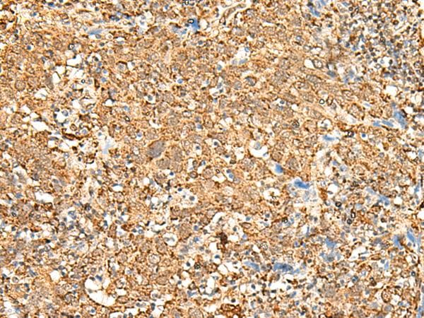 Polyclonal Rabbit anti-Human P2RY14 / GPR105 Antibody (IHC)
