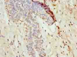 NANP Antibody