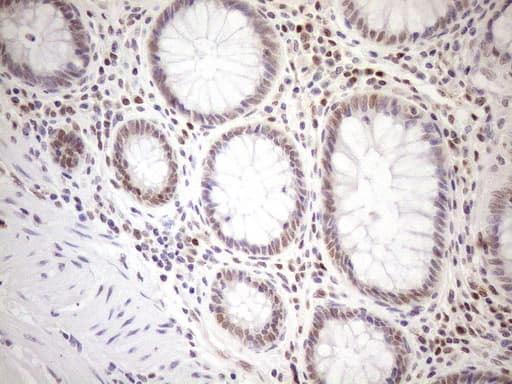 MGMT Antibody (clone OTI2E2)