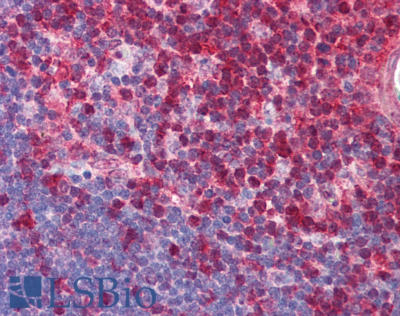 IHC-plus™ STAT1 Antibody