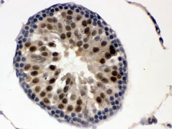 UBA3 / UBE1C Antibody