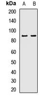 ECE-1 Antibody