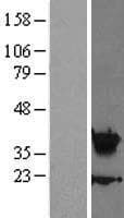 HOXA5 Protein (Over-Expression Lysate Myc-DDK (Flag))