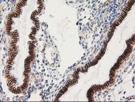 CTNNB1 / Beta Catenin Antibody (clone OTI1B11)