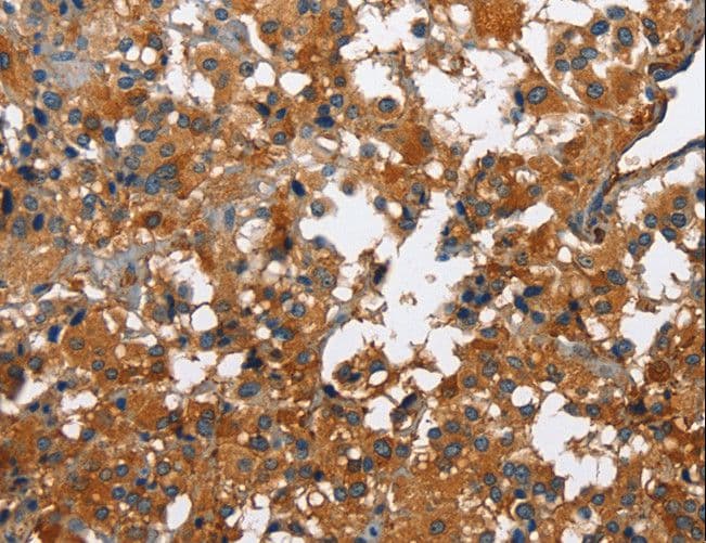 CATSPER3 Antibody