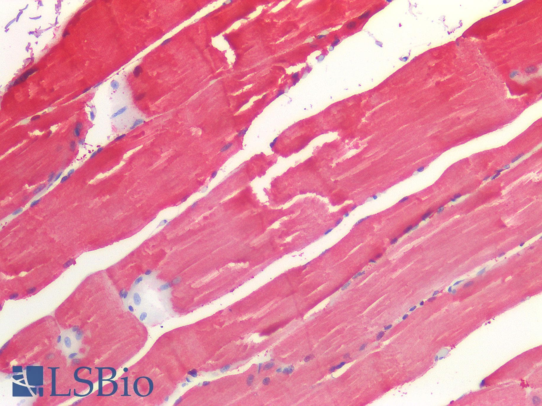 IHC-plus™ ROR1 Antibody (C-terminal)