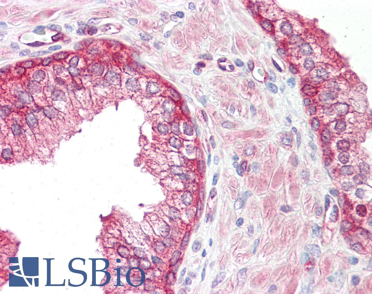 IHC-plus™ EEF2 / Elongation Factor 2 Antibody (aa31-80)