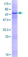Human ACTRT1 Protein (Recombinant GST)
